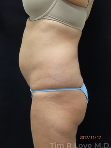 52 y/o female 5'2