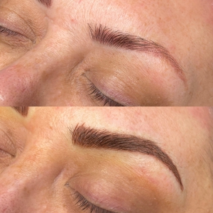 Correction Combo Eyebrows-before