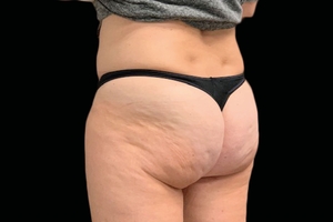 4 Treatments-before