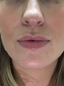 SaijeB&A_lipflip-after