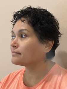 Veronica Salazar: EmFace: Sub/ Cheeks-before