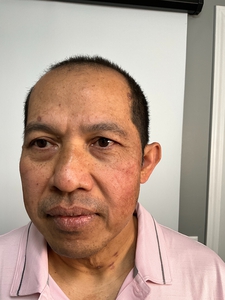 Before & After-after