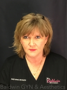 AFTER 2 TREATMENTS-after