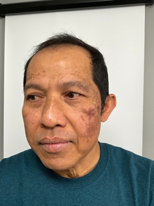 Before & After-before