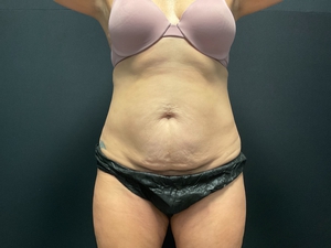 Compare-before