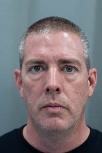 After Bio Repeel, Microneedling, VAMP, at home routine-before