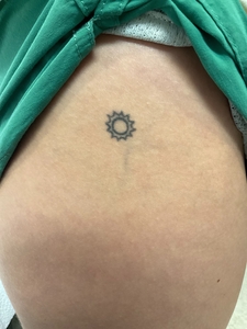 after 2 tretements-before