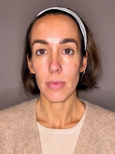 Laura Henderson - Moxi-after