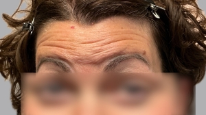 Compare-before