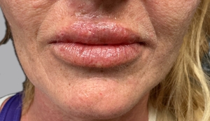 Compare-after