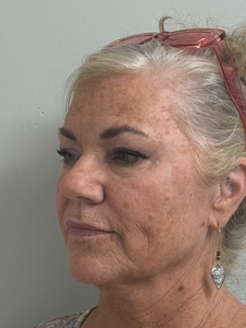 Vicky Bates 8/21-9/25-after