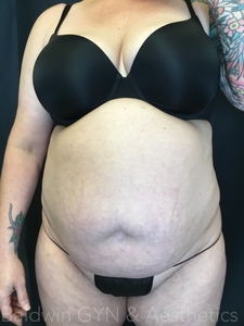 5 wks-before