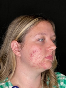 Trisha Sheehan LME.-before