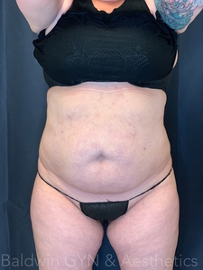 5 wks-after