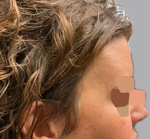 Compare-after