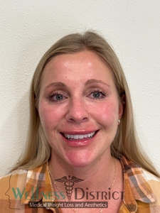 Immediately after and 60 days healed-before