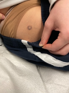 after 2 tretements-after