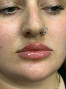 Whitney Devall RN. Versa-after