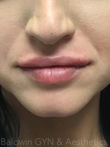 -after