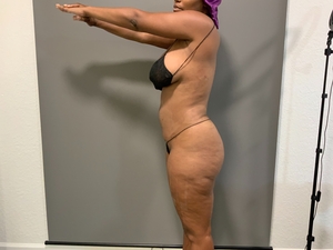 Denise Strickland Left Side-after