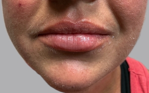 Compare-after