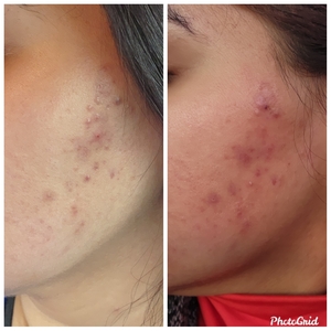 Dr. Ayala's Journey-before