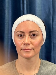 Compare-after