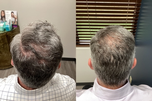 Compare after 3 TX's-before