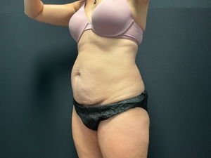 Compare-before