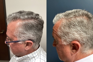 Compare after 3 TX's-before