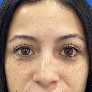 Lash Lift #1-after