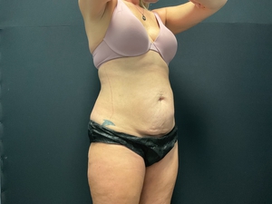 Compare-before