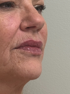 Vicky Bates 8/21-9/25-before