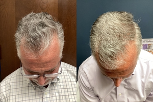 Compare after 3 TX's-before