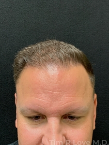 Compare-before