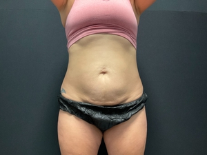 Compare-after