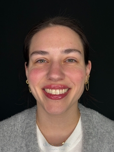 Danielle Glass, RN. - Versa-after