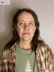 After 1 MN session-after