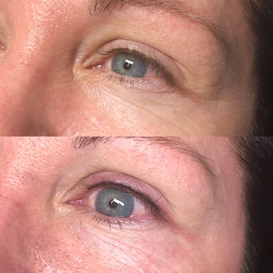 Lash Enhancement-before