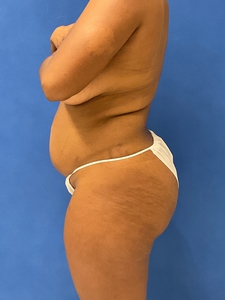 Adrianne Howard-after