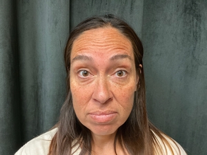 Compare-before