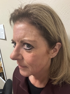 jillB&A_tixel-before