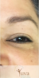 Lash Lift at Yuva-before