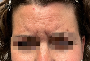Compare-before