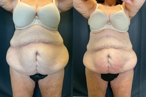 Compare-before