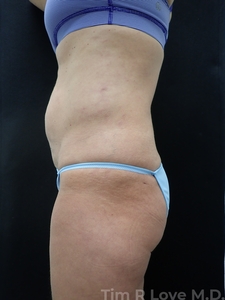 52 y/o female 5'2