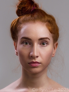 Woman 32 Facelift-after