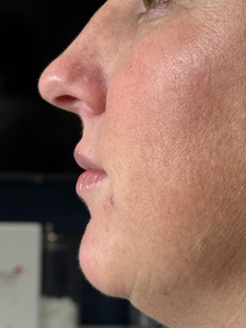 Compare-before