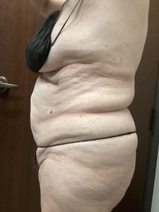 4 weeks after 6th Edge Session-after