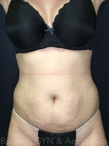 6 weeks-before